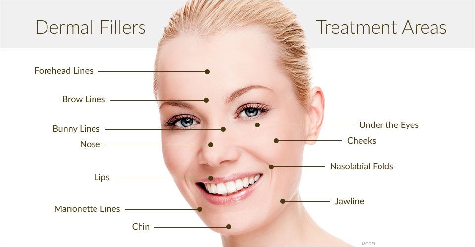 Dermal Fillers Injections Skn Cosmetics