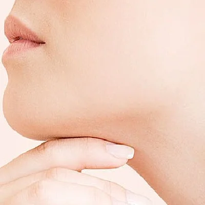 Double Chin Removal in Islamabad, Rawalpindi & Pakistan | Cost, Price