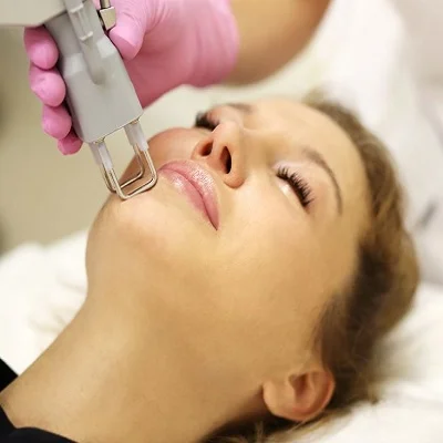 Laser Treatment for Hyperpigmentation on Face cost in Islamabad