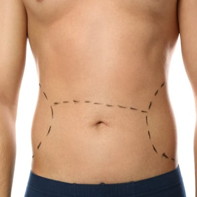 Tummy Tuck Belt In Pakistan  Invisible Skinee Tummy Tuck Belt in