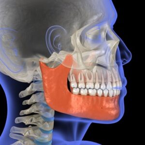 Jaw Surgery in Islamabad, Rawalpindi & Pakistan | Maxillofacial Surgeon