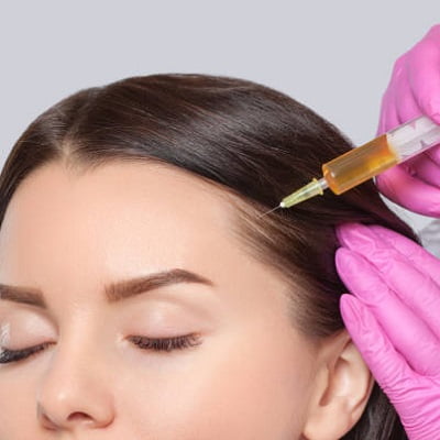 PRP Hair Treatment in Islamabad - PRP in Islamabad